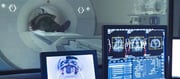 Doctors Treat Parkinson's Tremors Without Surgery.