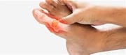 High Uric Acid Can Bring About Painful Situations!