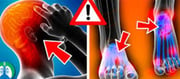Vitamin B12 deficiency can cause this dangerous disease!