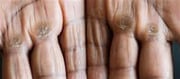 What home remedy is right for honest skin?