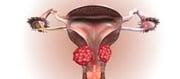 What is the right age for cervical cancer screening?
