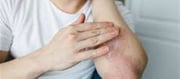 Why does itching get relieved by scratching?