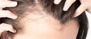 Pressure And Hair Loss In Girls: