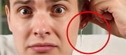 Tricks From Doctor - How to Remove Water from Your Ear After Bathing?