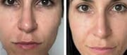 Turmeric Brightens Skin, Reduces Blemishes, And Glows
