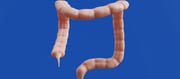 What You Eat Can Hurt Your Appendix - Avoid These Foods At Any Cost