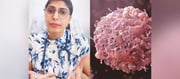 Why Are Cancer Cases Increasing By The Day? AIIMS Expert Says...