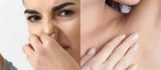 Summer season skin care tip: