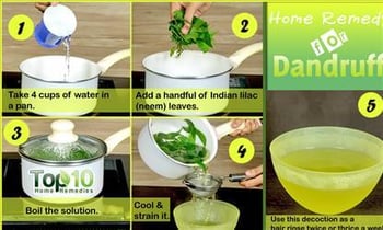 BEAUTY : Home remedies to control hair fall. BEAUTY : Home remedies to control hair fall.