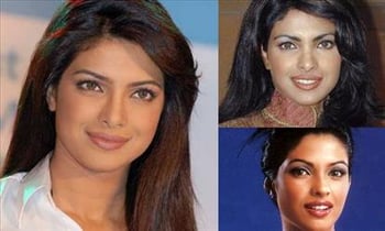 Bollywood actress who turned from Ugly to Beautiful Bollywood actress who turned from Ugly to Beautiful