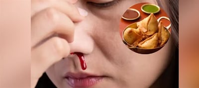 These Four Foods Are Guaranteed To Cause CANCER - Scientists Have Given Proof