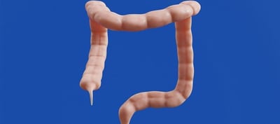 What You Eat Can Hurt Your Appendix - Avoid These Foods At Any Cost