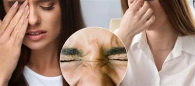 Is eye twitching severe? Explain