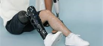 Where can one get the cheapest artificial limbs in the country?
