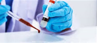 Japan Has Created Synthetic Blood That Would Keep Lives;