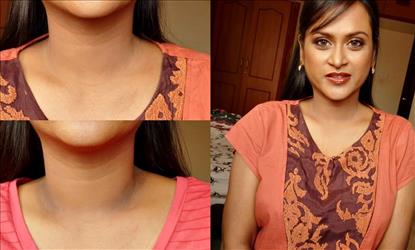 Home remedies for Dark neck