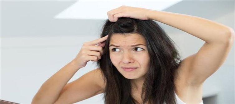 చుండ్రు సమస్యకి శాశ్వతంగా ఇలా చెక్ పెట్టండి..