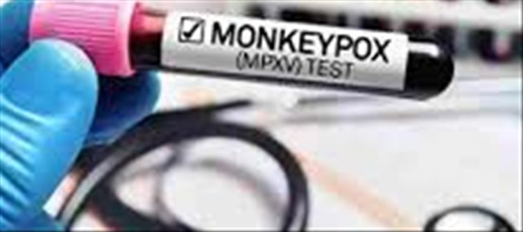 Alert regarding monkeypox! Delhi AIIMS issued guidelines