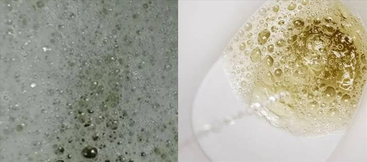 Are you Foaming when you urinate? Your Health Is In Serious Trouble
