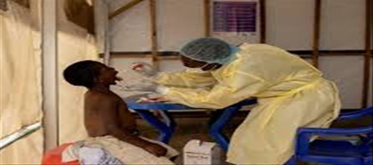Can we stop the monkeypox that is plaguing Africa..!?