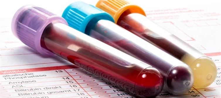 Every Indian Should Take These Critical Tests Before It's Too Late Says Famous Nutritionist