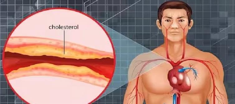 If you are having pain in this part of the body, it means Cholesterol Has Increased and it's a Warning