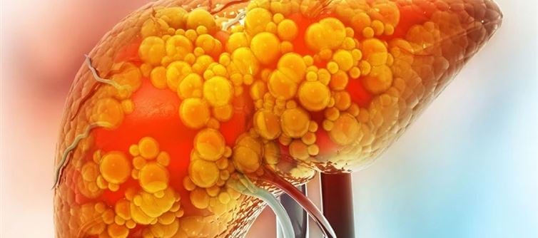 Just like alcohol, these 5 foods are as toxic for the liver