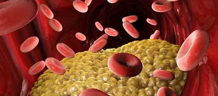 NO Tablets - Get Rid Of High Cholesterol With These Natural Methods