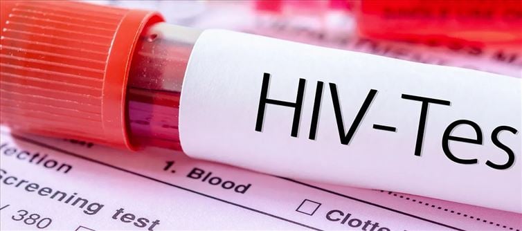 Projected Upward Thrust In HIV-Associated Deaths By Using 2030:
