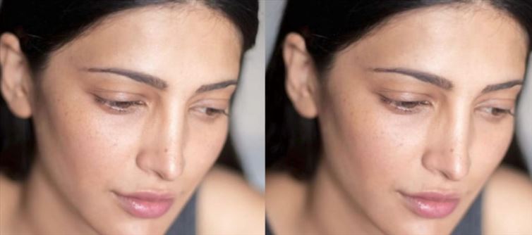 Shruti Haasan rocks a No-makeup look - Flaunts Freckles on her Face
