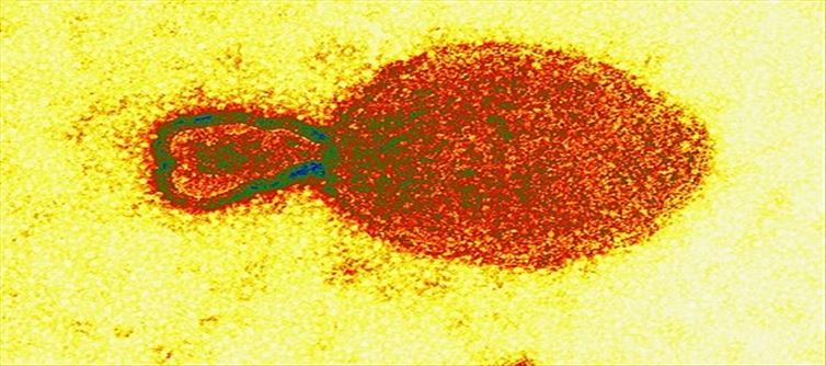 బాబోయ్.. చైనా నుంచి మరో కొత్త వైరస్‌?