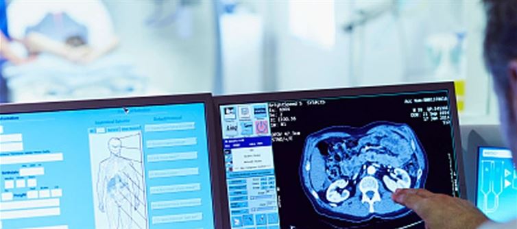 A Stressful Upward Thrust In Hospitalizations For A Common Stroke Motive