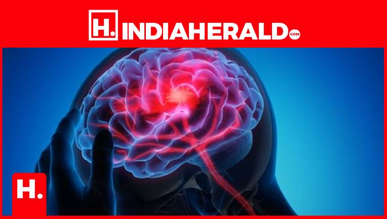 brain-stroke-5-main-reason