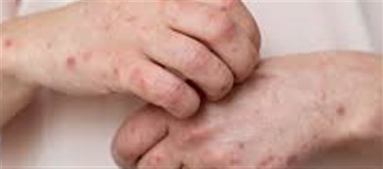 Could Your Skin Indicate Potential Heart Problems?
