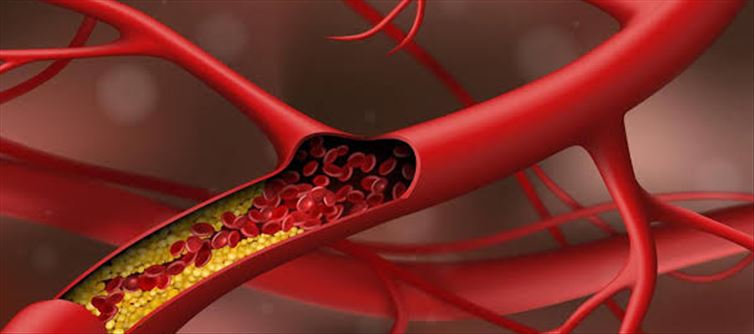 ఈ టీ తాగితే బాడీలో ఎంతటి కొవ్వైనా కరగాల్సిందే?