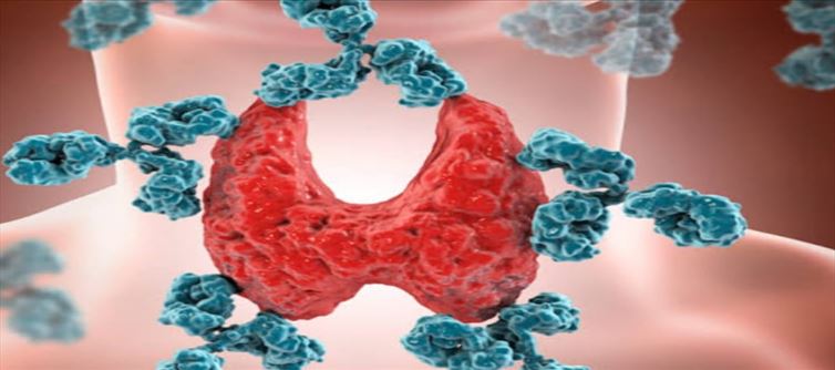 What Is Hashimoto Thyroiditis?