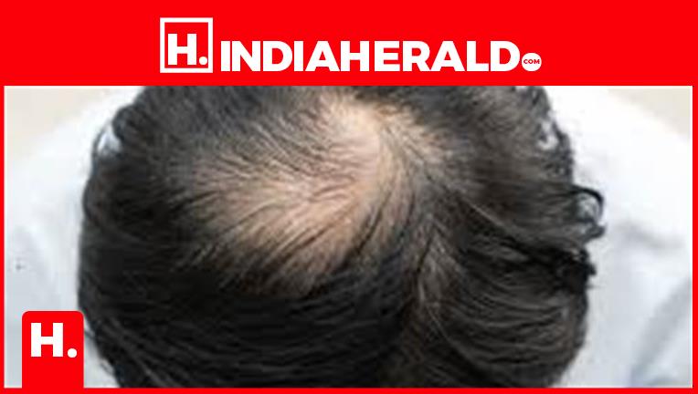 Ancient Chinese Medicine Could Hold the Secret to Hair Regrowth