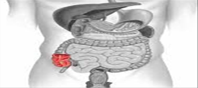 పేగు ఆరోగ్యాన్ని కాపాడే ఆహారాలు ఏంటో తెలుసా..!