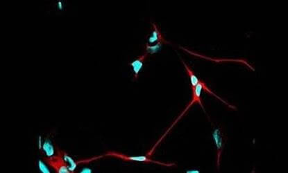 Indian team discovers a switch for 'Brain Development'