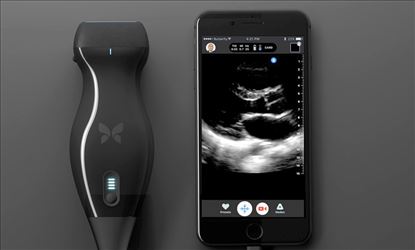 Can this iPhone based Ultrasound Machine detect Cancer?? 