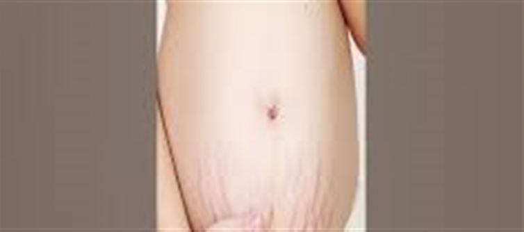 "Causes And Solutions For Varicose Veins."