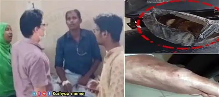 వైరల్ : వ్యక్తిని కాటేసి.. చనిపోయిన కింగ్ కోబ్రా?