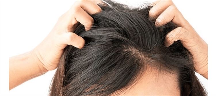 తలలో పేలసమస్యతో బాధపడుతున్నారా.. !!అయితే ఒకసారి ఇలా చేయండి.. !!